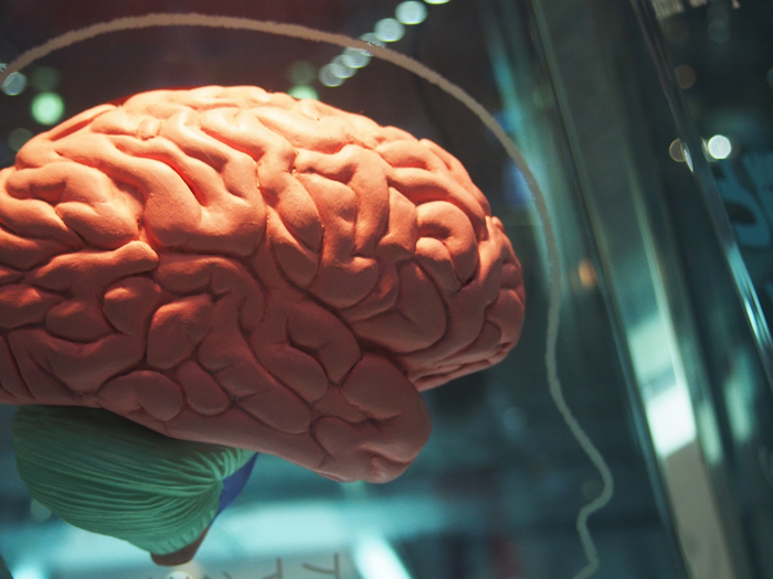 脳の写真