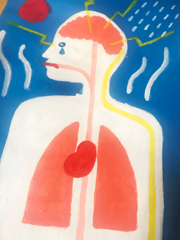 頭痛　イラストレーション